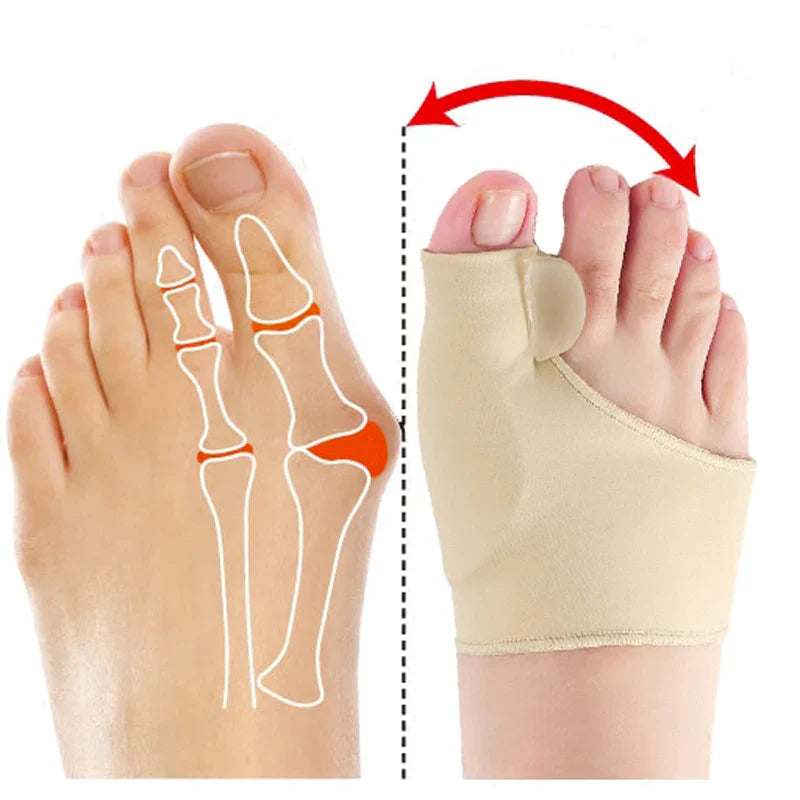 Transformez vos pieds avec notre correcteur d'oignons