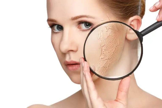 ¿Qué ingredientes deben estar presentes en los productos para piel seca? - Multishop Chile E.I.R.L