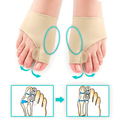 Transformez vos pieds avec notre correcteur d'oignons 